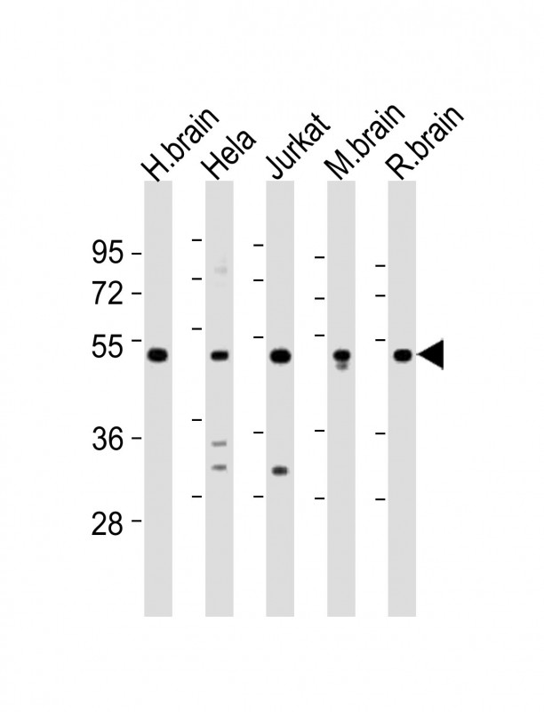 All lanes : Anti-CHST1 Antibody (C-term) at 1:2000 dilutionLane 1: human brain lysatesLane 2: Hela whole cell lysatesLane 3: Jurkat whole cell lysatesLane 4: mouse brain lysatesLane 5: rat brain lysatesLysates/proteins at 20 �g per lane. SecondaryGoat Anti-Rabbit IgG,  (H+L), Peroxidase conjugated at 1/10000 dilutionPredicted band size : 47 kDaBlocking/Dilution buffer: 5% NFDM/TBST.