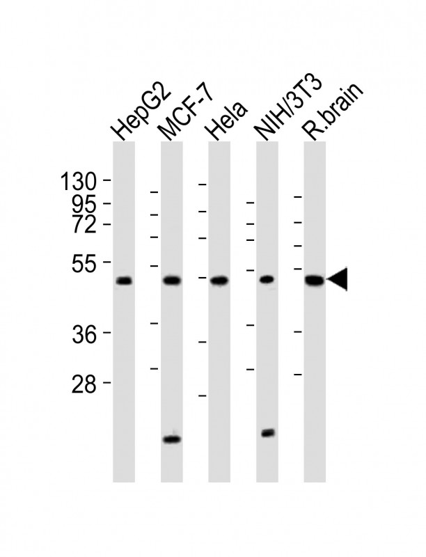 All lanes : Anti-PPP2R2A Antibody (N-term) at 1:2000 dilutionLane 1: HepG2 whole cell lysatesLane 2: MCF-7 whole cell lysatesLane 3: Hela whole cell lysatesLane 4: NIH/3T3 whole cell lysatesLane 5: rat brain lysatesLysates/proteins at 20 �g per lane. SecondaryGoat Anti-Rabbit IgG,  (H+L), Peroxidase conjugated at 1/10000 dilutionPredicted band size : 52 kDaBlocking/Dilution buffer: 5% NFDM/TBST.