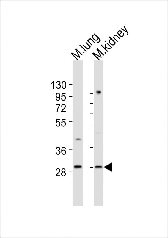 WB - Mouse Hoxb4 Antibody (C-term) AP21238b