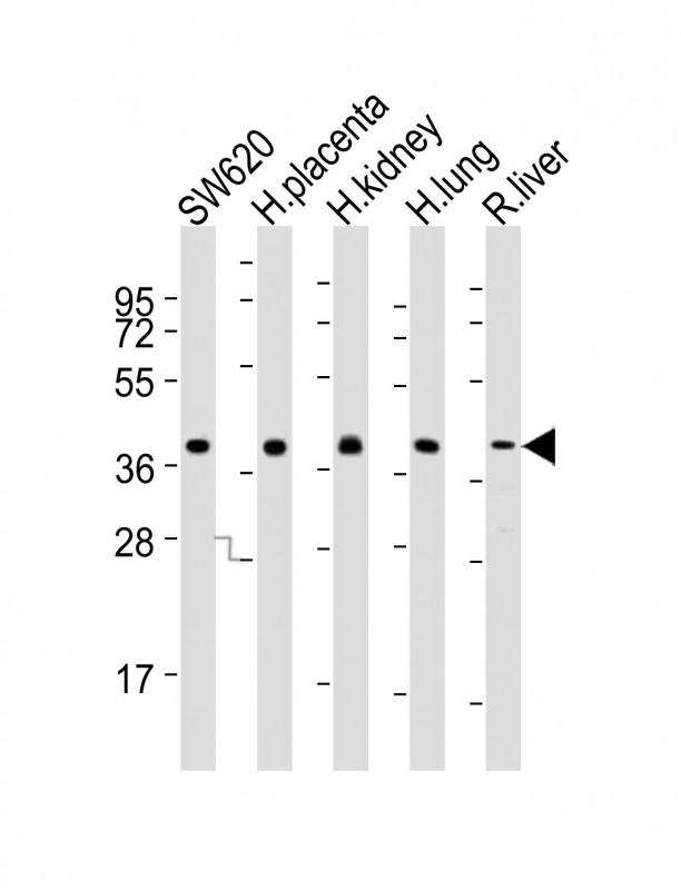 All lanes : Anti-PPAP2B Antibody (N-term) at 1:2000 dilutionLane 1: SW620 whole cell lysatesLane 2: human placenta lysatesLane 3: human kidney lysatesLane 4: human lung lysatesLane 5: rat liver lysatesLysates/proteins at 20 �g per lane. SecondaryGoat Anti-Rabbit IgG,  (H+L), Peroxidase conjugated at 1/10000 dilutionPredicted band size : 35 kDaBlocking/Dilution buffer: 5% NFDM/TBST.