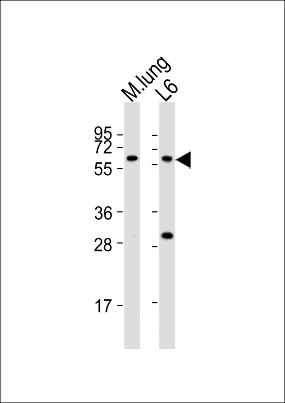 All lanes : Anti-Yes1 Antibody (Center) at 1:2000 dilutionLane 1: mouse lung lysatesLane 2: L6 whole cell lysatesLysates/proteins at 20 �g per lane. SecondaryGoat Anti-Rabbit IgG,  (H+L), Peroxidase conjugated at 1/10000 dilutionPredicted band size : 61 kDaBlocking/Dilution buffer: 5% NFDM/TBST.