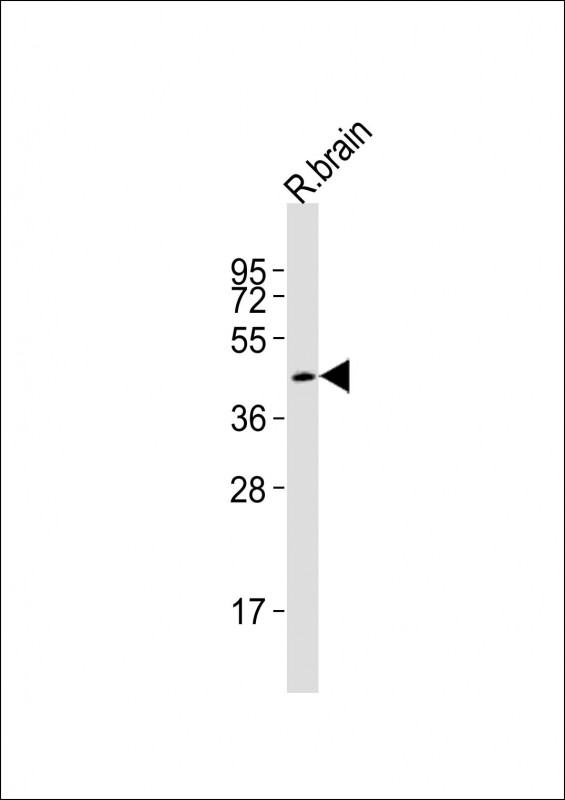 Anti-Smad3 Antibody (Center)at  1:2000 dilution + rat brain lysatesLysates/proteins at 20 �g per lane. SecondaryGoat Anti-Rabbit IgG,  (H+L), Peroxidase conjugated at 1/10000 dilutionPredicted band size : 48 kDaBlocking/Dilution buffer: 5% NFDM/TBST.