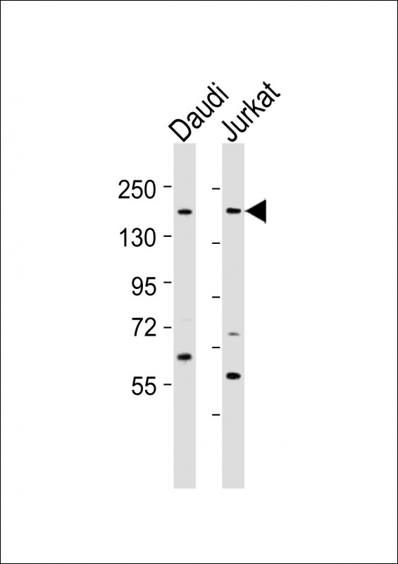 WB - BZRAP1 Antibody (C-term) AP21258b