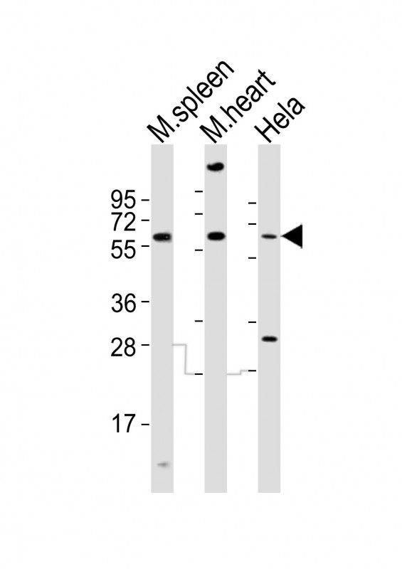 All lanes : Anti-Rad9a Antibody (C-term) at 1:2000 dilutionLane 1: mouse spleen lysatesLane 2: mouse heart lysatesLane 3: Hela whole cell lysatesLysates/proteins at 20 �g per lane. SecondaryGoat Anti-Rabbit IgG,  (H+L), Peroxidase conjugated at 1/10000 dilutionPredicted band size : 42 kDaBlocking/Dilution buffer: 5% NFDM/TBST.