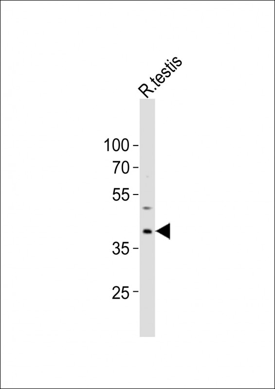 Anti-PCGF6 Antibody (Center)at  1:2000 dilution + rat testis lysatesLysates/proteins at 20 �g per lane. SecondaryGoat Anti-Rabbit IgG,  (H+L), Peroxidase conjugated at 1/10000 dilutionPredicted band size : 39 kDaBlocking/Dilution buffer: 5% NFDM/TBST.