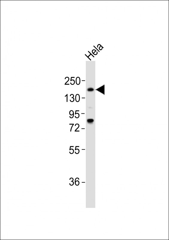 WB - LAMA4 Antibody (C-term) AP21315b