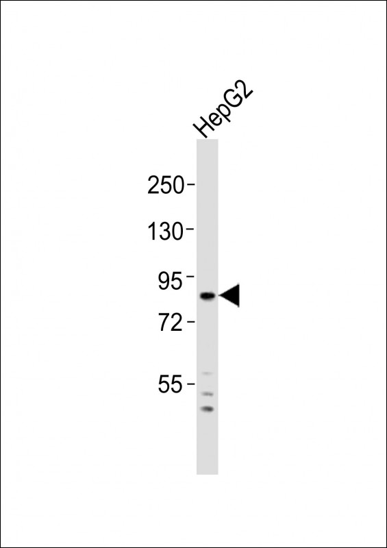 Anti-ADAM15 Antibody (N-Term)at  1:2000 dilution + HepG2 whole cell lysatesLysates/proteins at 20 �g per lane. SecondaryGoat Anti-Rabbit IgG,  (H+L), Peroxidase conjugated at 1/10000 dilutionPredicted band size : 93 kDaBlocking/Dilution buffer: 5% NFDM/TBST.