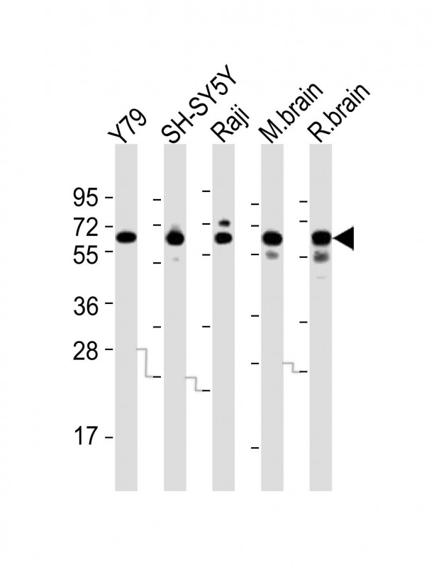 All lanes : Anti-DPYSL5 Antibody (C-term) at 1:2000 dilutionLane 1: Y79 whole cell lysatesLane 2: SH-SY5Y whole cell lysatesLane 3: Raji whole cell lysatesLane 4: mouse brain lysatesLane 5: rat brain lysatesLysates/proteins at 20 �g per lane. SecondaryGoat Anti-Rabbit IgG,  (H+L), Peroxidase conjugated at 1/10000 dilutionPredicted band size : 61 kDaBlocking/Dilution buffer: 5% NFDM/TBST.