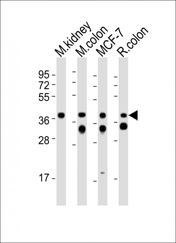 All lanes : Anti-Epcam Antibody (C-term) at 1:2000 dilutionLane 1: mouse kidney lysatesLane 2: mouse colon lysatesLane 3: MCF-7 whole cell lysatesLane 4: rat colon lysatesLysates/proteins at 20 �g per lane. SecondaryGoat Anti-Rabbit IgG,  (H+L), Peroxidase conjugated at 1/10000 dilutionPredicted band size : 35 kDaBlocking/Dilution buffer: 5% NFDM/TBST.