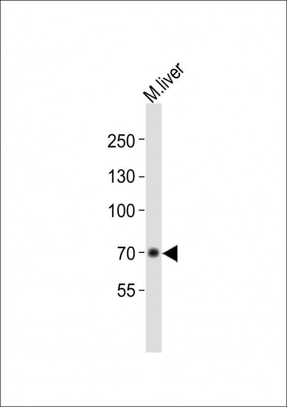 Anti-ALB Antibody (C-term)at  1:1000 dilution + mouse liver lysatesLysates/proteins at 20 �g per lane. SecondaryGoat Anti-Rabbit IgG,  (H+L), Peroxidase conjugated at 1/10000 dilutionPredicted band size : 70 kDaBlocking/Dilution buffer: 5% NFDM/TBST.