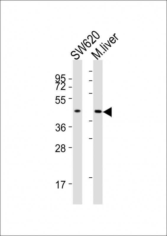 All lanes : Anti-ACAT1 Antibody (C-term) at 1:2000 dilutionLane 1: SW620 whole cell lysatesLane 2: mouse liver lysatesLysates/proteins at 20 �g per lane. SecondaryGoat Anti-Rabbit IgG,  (H+L), Peroxidase conjugated at 1/10000 dilutionPredicted band size : 45. 2 kDaBlocking/Dilution buffer: 5% NFDM/TBST.