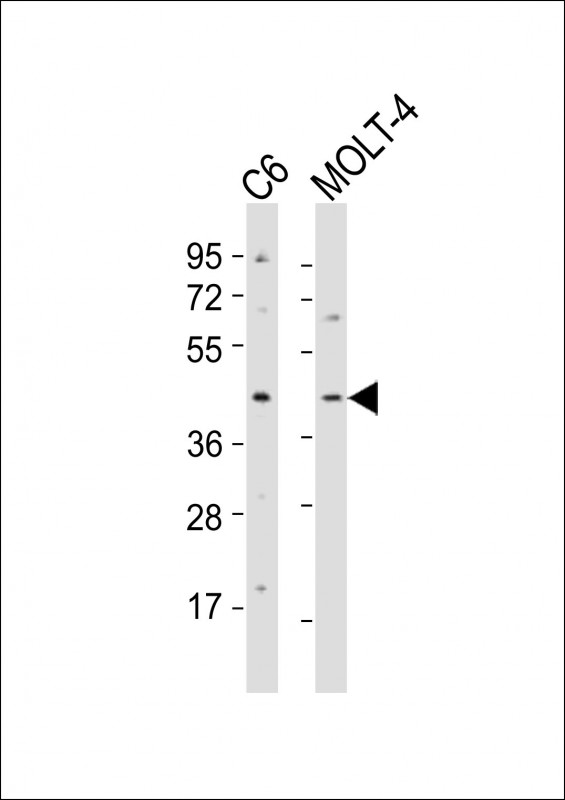 All lanes : Anti-CSNK2A1 Antibody (Y255) at 1:2000 dilutionLane 1: C6 whole cell lysatesLane 2: MOLT-4 whole cell lysatesLysates/proteins at 20 �g per lane. SecondaryGoat Anti-Rabbit IgG,  (H+L), Peroxidase conjugated at 1/10000 dilutionPredicted band size : 45 kDaBlocking/Dilution buffer: 5% NFDM/TBST.