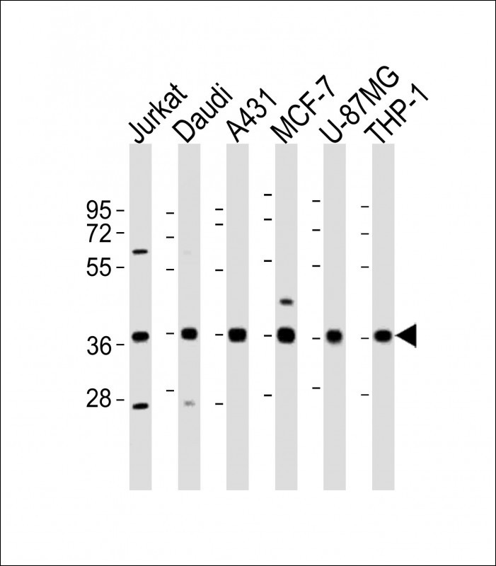 WB - MICA Antibody (Center) AW5477-U100