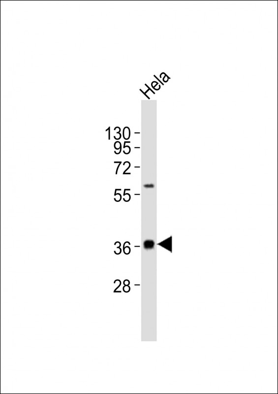 WB - MICA Antibody (Center) AW5477-U100