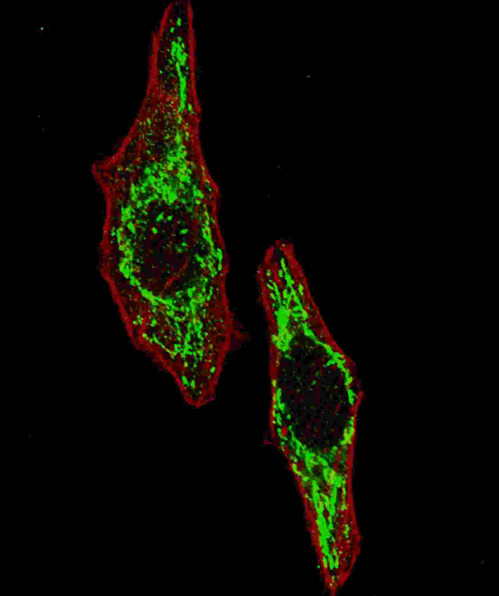 IF - HSPD1 Antibody (Center) AW5147-U100