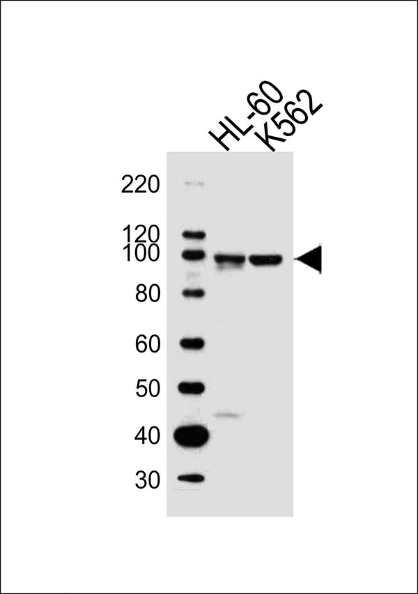 WB - ITGB2 Antibody AW5254-U100