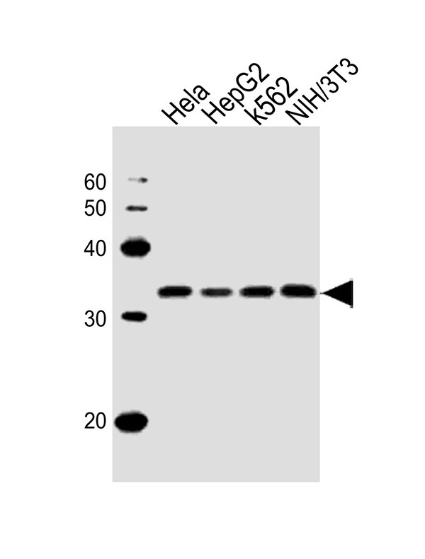 WB - RPS6 Antibody (N-term) AW5080-U100