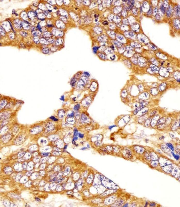 IHC-P - MICA Antibody (Center) AW5477-U100