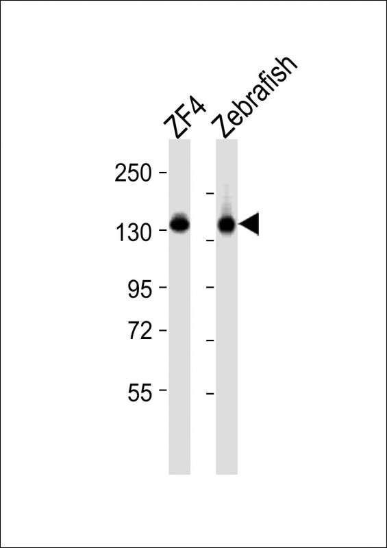 All lanes : Anti-cyfip1 Antibody (Center) at 1:2000 dilutionLane 1: ZF4 whole cell lysatesLane 2: Zebrafish lysatesLysates/proteins at 20 �g per lane. SecondaryGoat Anti-Rabbit IgG,  (H+L), Peroxidase conjugated at 1/10000 dilutionPredicted band size : 145 kDaBlocking/Dilution buffer: 5% NFDM/TBST.