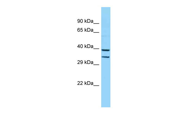 WB - Hoxb5 antibody - middle region AI10230