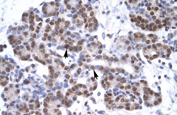 IHC - MYF6 antibody - N-terminal region AI10315