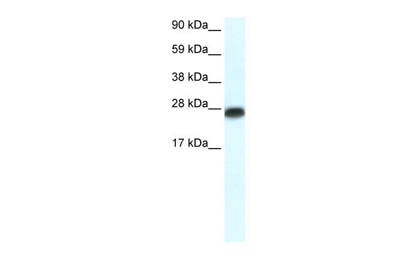 WB - MYF6 antibody - N-terminal region AI10315