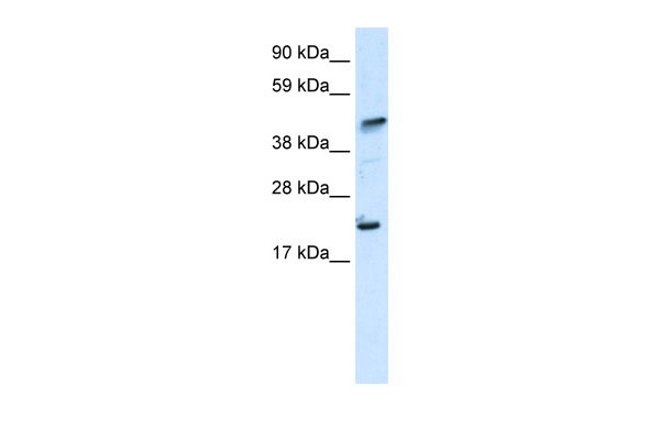 WB - ZNFN1A5 antibody - N-terminal region AI10486