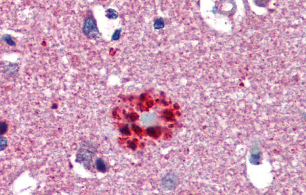 IHC - TCF21 antibody - N-terminal region AI10514