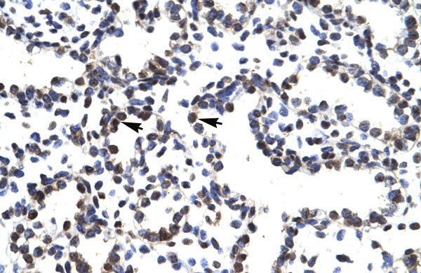 IHC - LHX3 antibody - middle region AI10541