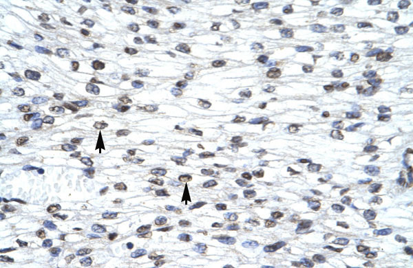 IHC - LHX3 antibody - middle region AI10541