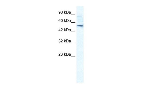 WB - SMPDL3B antibody - N-terminal region AI10573