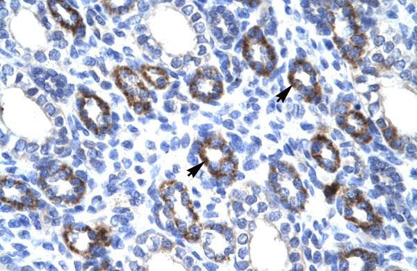 IHC - RGS6 antibody - C-terminal region AI10600