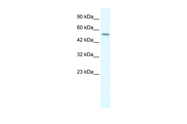 WB - RGS6 antibody - C-terminal region AI10600