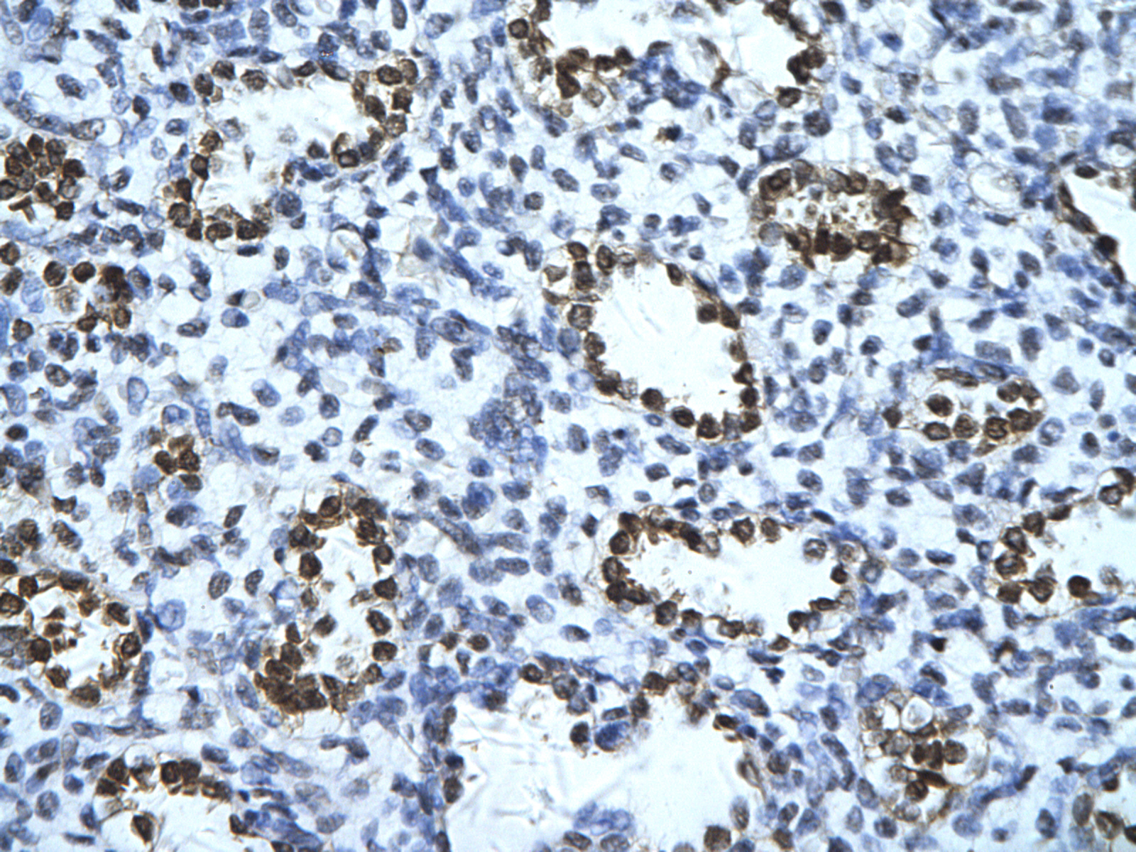 IHC - ENO1 antibody - C-terminal region AI10640