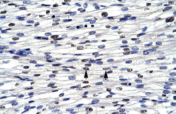 IHC - CGI-143 antibody - N-terminal region AI10653