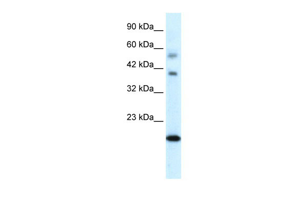 WB - CGI-143 antibody - N-terminal region AI10653