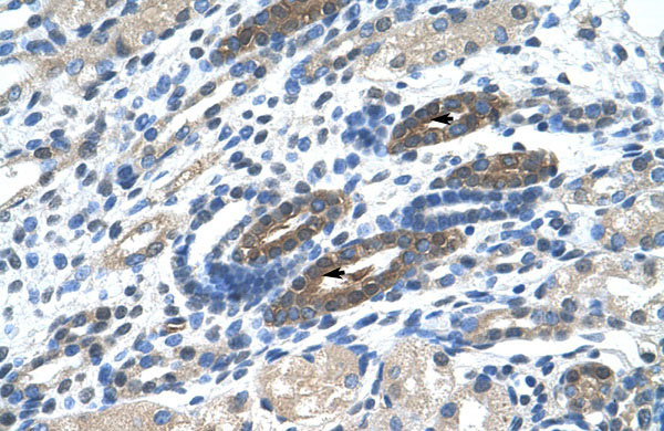 IHC - BTBD14A antibody - N-terminal region AI10700