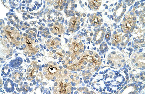IHC - TAF6 antibody - N-terminal region AI10708
