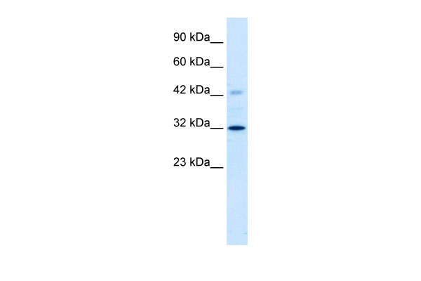 WB - VDAC1 antibody - C-terminal region AI10793