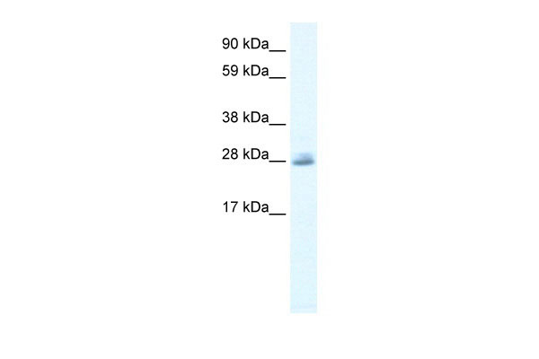 WB - CLIC5 antibody - C-terminal region AI10811