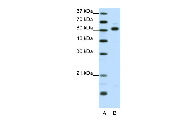 WB - TRIP4 antibody - middle region AI10906