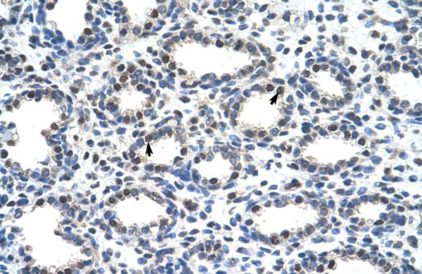 IHC - SMARCD2 antibody - C-terminal region AI11379