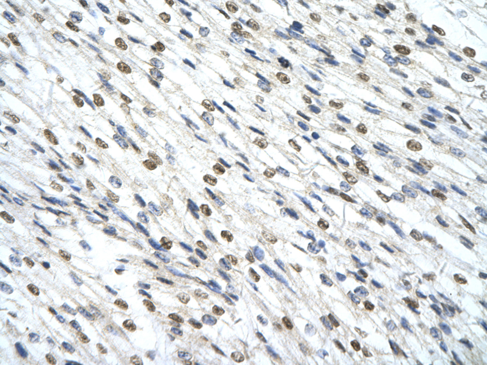 IHC - SMARCD2 antibody - C-terminal region AI11379