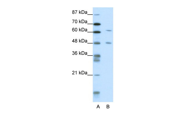 WB - NAB2 antibody - N-terminal region AI11449
