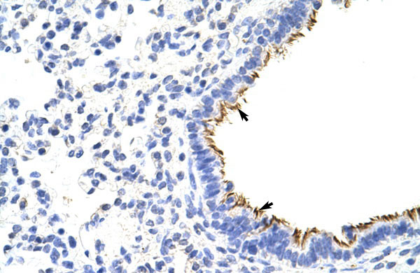 IHC - ZNF16 antibody - N-terminal region AI11472