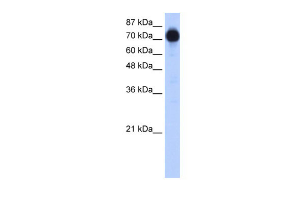 WB - ZNF16 antibody - N-terminal region AI11472