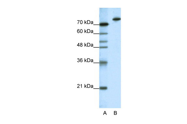 WB - KLHL3 antibody - N-terminal region AI11522