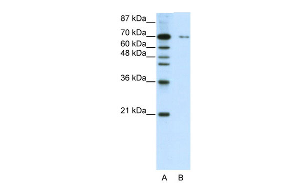 WB - ZNF398 antibody - C-terminal region AI11655