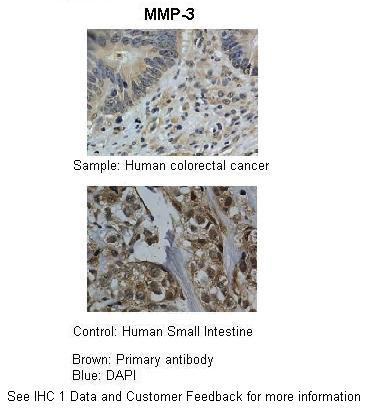 IHC - MMP3 antibody - middle region AI11969