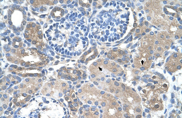 IHC - SARDH antibody - middle region AI12004